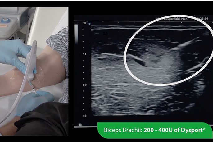 Ultrasound Essentials – Elbow