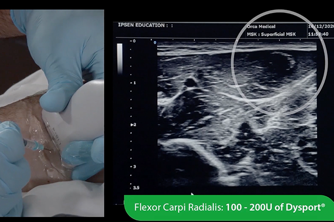 Ultrasound Essentials – Forearm