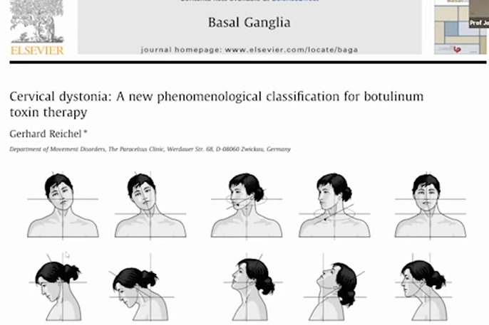 Advanced concepts in diagnosis and therapy of cervical dystonia: The Col-Cap-Concept