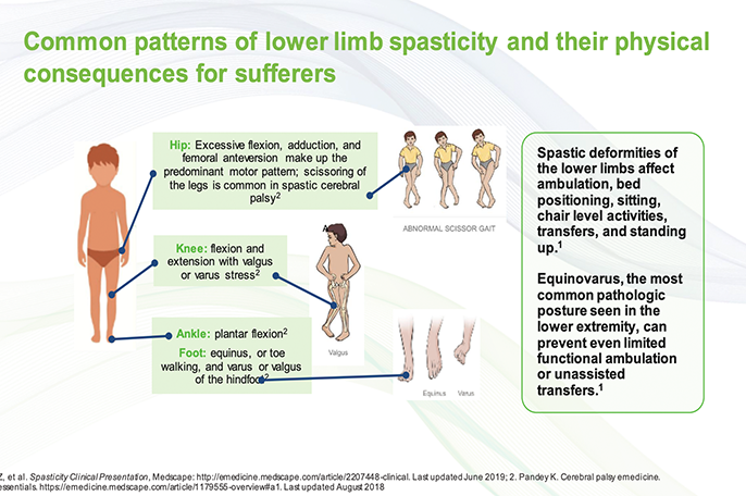 Overview of Paediatric Spasticity – eLearning Module